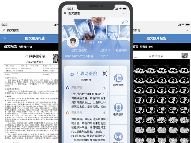 二维码图文报告系统图示
